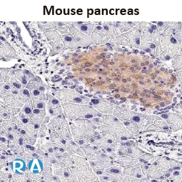 GLP1R antibody [HL2297]